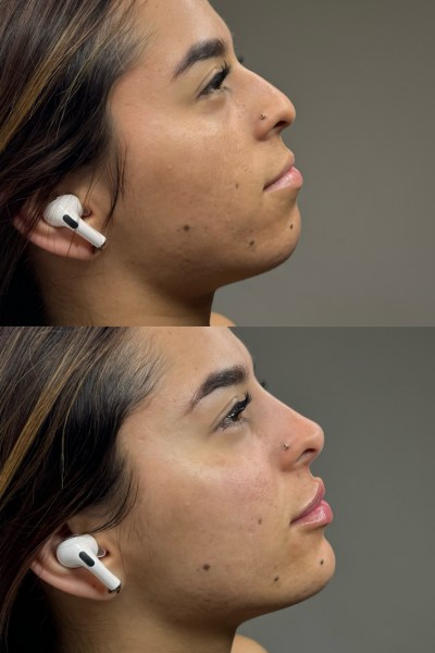 armonizacion fergo clinic