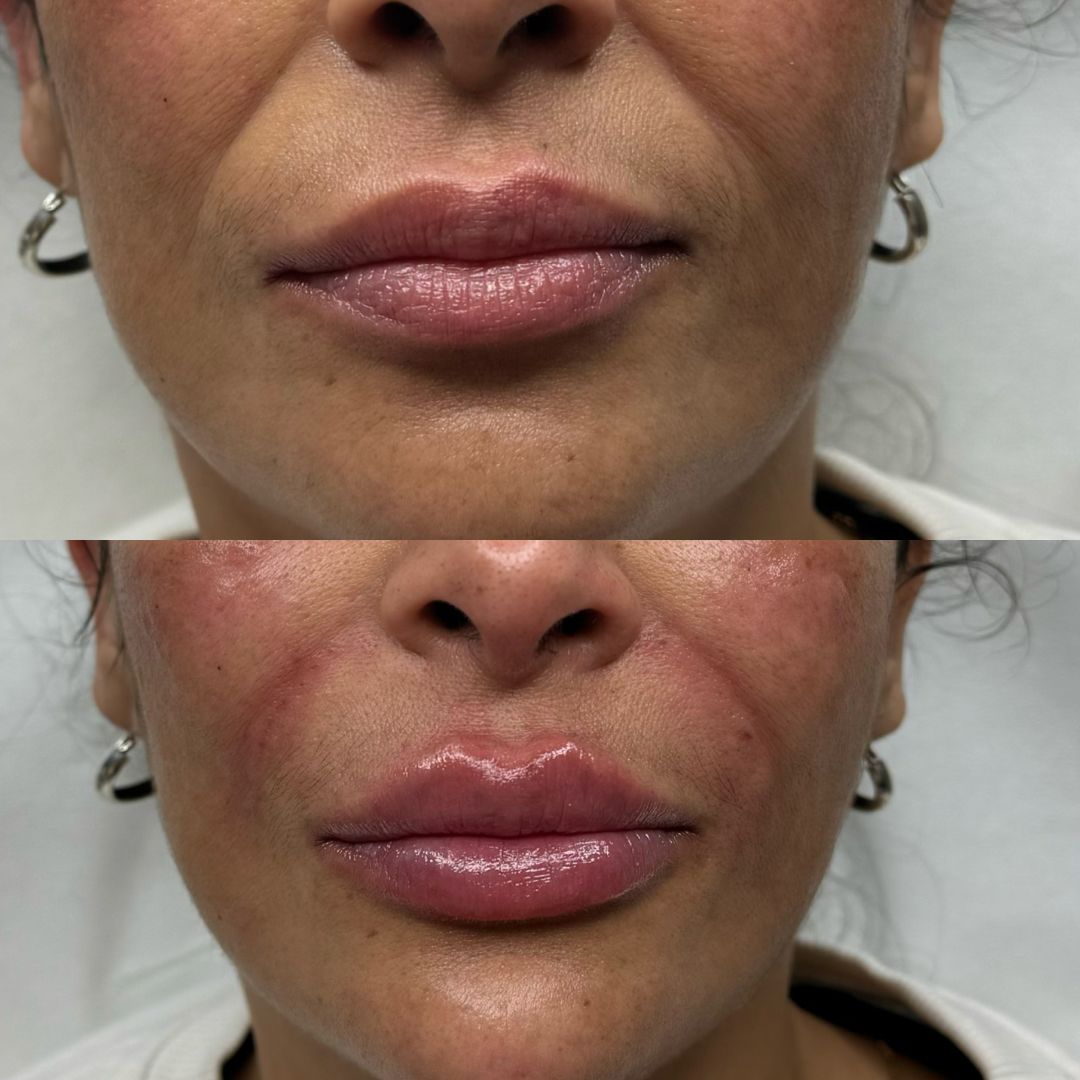 surconasogeniano estefania fernandez aestethic